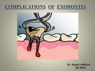 COMPLICATIONS OF EXODONTIA
By- Ragini Adhikari
(III BDS)
 