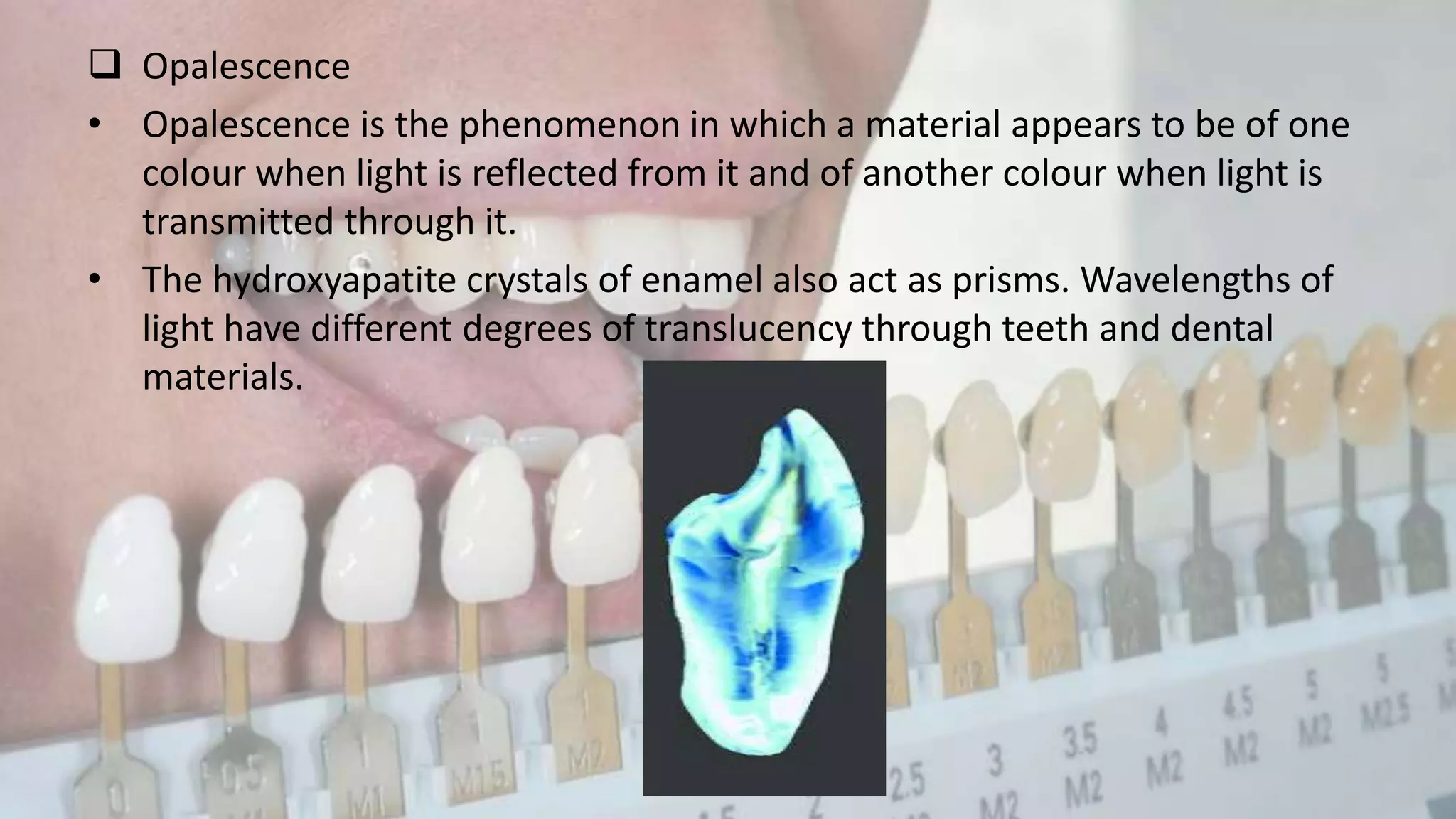 Opalescence Example Shade selection in FPD | PPTX