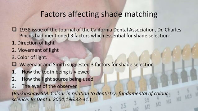 Shade selection in FPD | PPTX