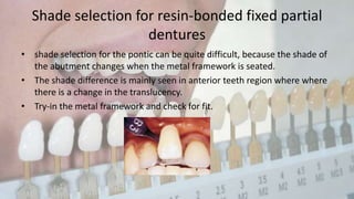 Shade selection in FPD | PPTX