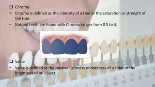 Shade selection in FPD | PPTX