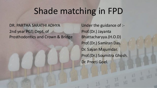 Porcelain Crown Color Chart