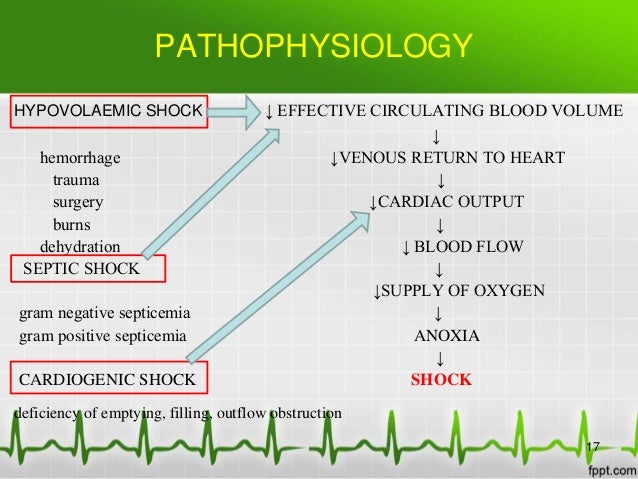Pathophysiology Of Shock Flow Chart