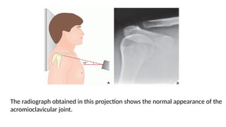 THE RADIOLOGICAL ANATOMY OF THE SHOULDER JOINT AND METHODS OF ...