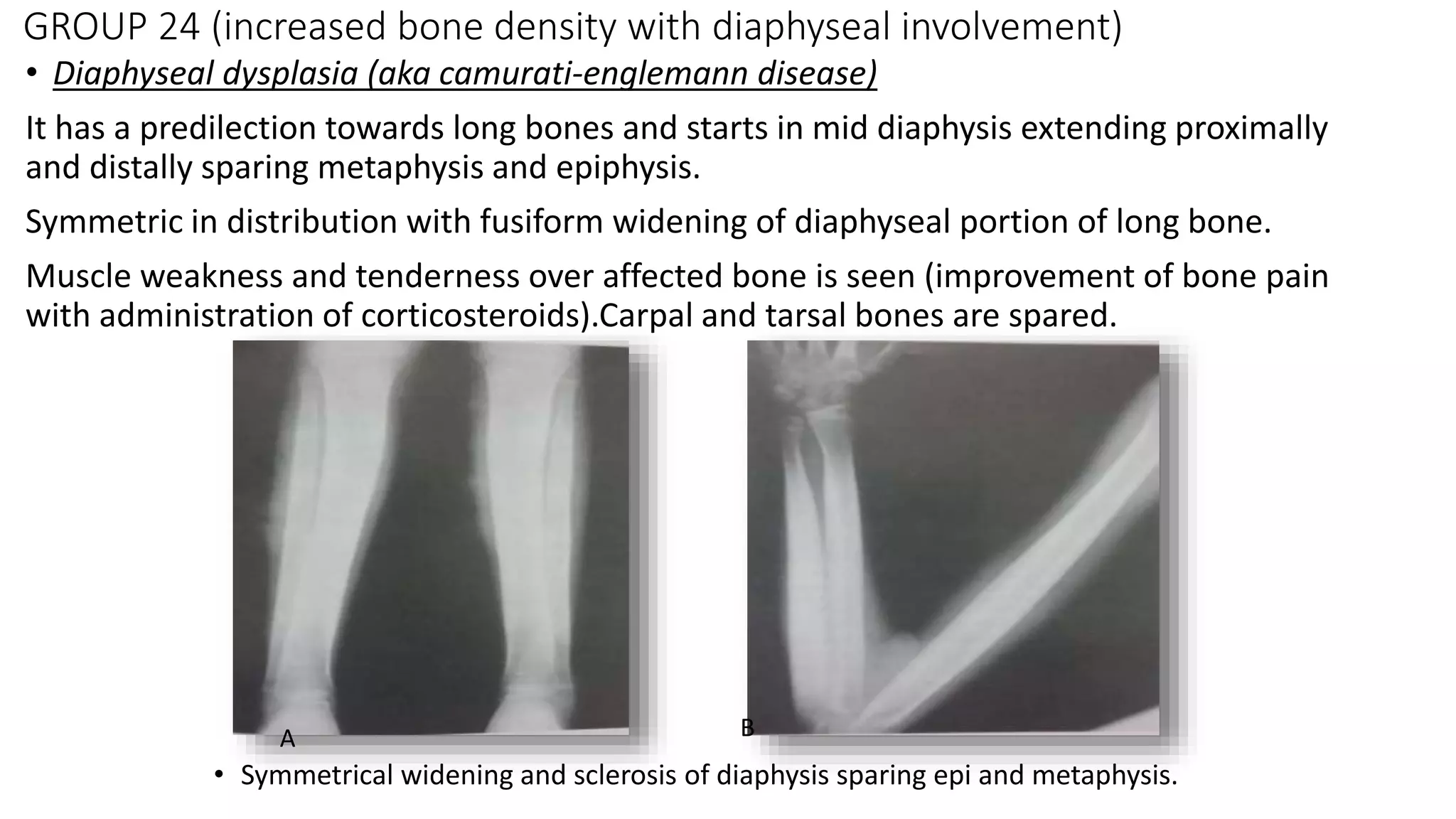 skeletal dysplasia ppt | PPTX