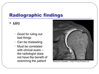 Radiographic findings
 MRI
• Good for ruling out
bad things
• Can be misleading
• Must be correlated
with clinical exam –
the radiologist does
not have the benefit of
examining the patient
 