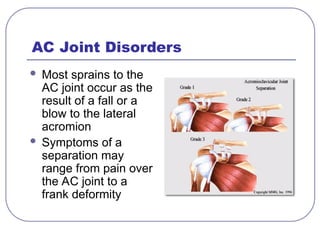 AC Joint Disorders
 Most sprains to the
AC joint occur as the
result of a fall or a
blow to the lateral
acromion
 Symptoms of a
separation may
range from pain over
the AC joint to a
frank deformity
 