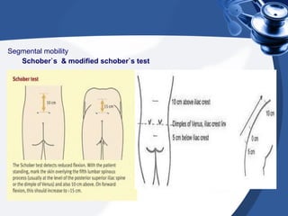clinical examination of spine | PPT