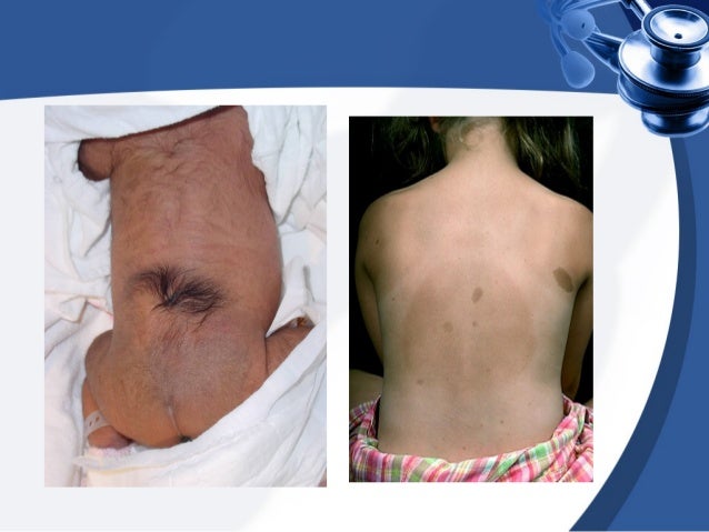 Clinical Examination Of Spine clinical-examination-of-spine