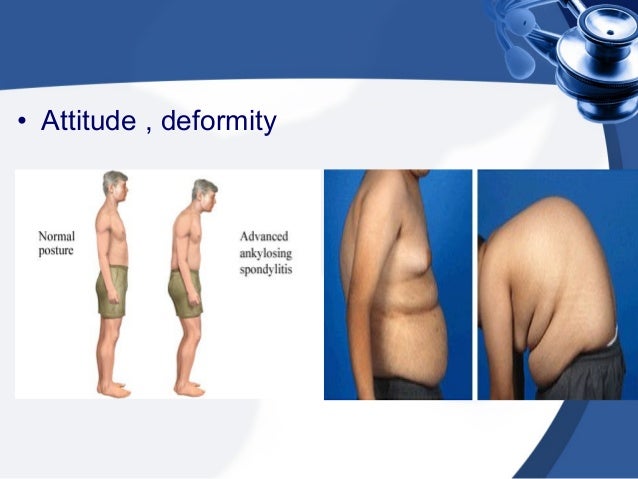 clinical examination of spine