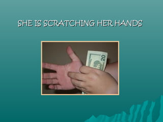SHE IS SCRATCHING HER HANDS
 