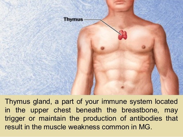 pharmacology of myasthenia gravis