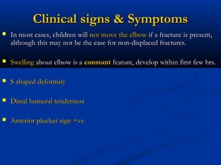 supracondylar fracture humerus in children