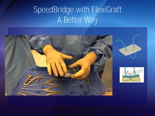 SpeedBridge with FlexiGraft 
A Better Way 
 