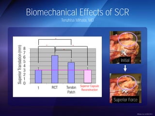 Biomechanical Effects of SCR 
Teruhisa Mihata, MD 
Initial 
Superior Force 
Mihata et al, AJSM 2012 
 