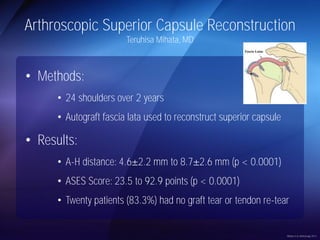 Arthroscopic Superior Capsule Reconstruction 
Teruhisa Mihata, MD 
• Methods: 
• 24 shoulders over 2 years 
• Autograft fascia lata used to reconstruct superior capsule 
• Results: 
• A-H distance: 4.6 2.2 mm to 8.7 2.6 mm (p < 0.0001) 
• ASES Score: 23.5 to 92.9 points (p < 0.0001) 
• Twenty patients (83.3%) had no graft tear or tendon re-tear 
Mihata et al, Arthroscopy 2013 
 