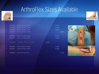 ArthroFlex Sizes Available 
• AFLEX100 3.5 cm x 3.5 cm x 1.5 mm $2,225 
• AFLEX101 4.0 cm x 7.0 cm x 1.5 mm $2,650 
• AFLEX103 5.0 cm x 9.0 cm x 1.5 mm $3,600 
• AFLEX150 1.5 cm x 14.0 cm x 1.5 mm $2,000 
• AFLEX200 3.5 cm x 3.5 cm x 2.0 mm $2,975 
• AFLEX201 4.0 cm x 7.0 cm x 2.0 mm $3,600 
• AFLEX301 4.0 cm x 7.0 cm x 3.5 mm $3,850 
• AFLEX400 4.0 cm x 4.0 cm x 1.0 mm $2,050 
• AFLEX401 4.0 cm x 7.0 cm x 1.0 mm $2,500 
• AFLEX500 3.0 cm x 4.0 cm x .5 mm $1,150 
 