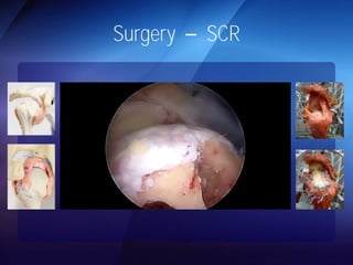 Surgery SCR 
 