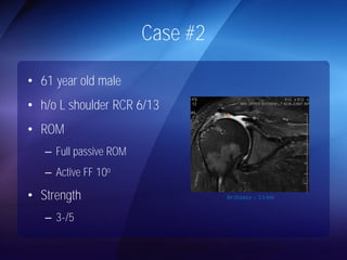 Case #2 
• 61 year old male 
• h/o L shoulder RCR 6/13 
• ROM 
– Full passive ROM 
– Active FF 10o 
• Strength 
– 3-/5 
AH Distance = 3.5 mm 
 
