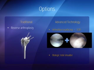 Options 
Traditional 
• Reverse arthroplasty 
Advanced Technology 
• ArthroFlex resurfacing + SCR 
• Biologic total shoulder 
 