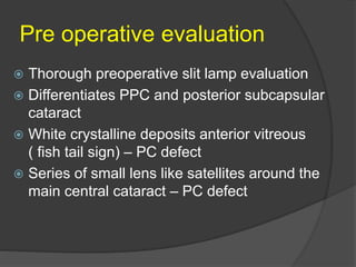 My technique to handle posterior polar cataract | PPTX
