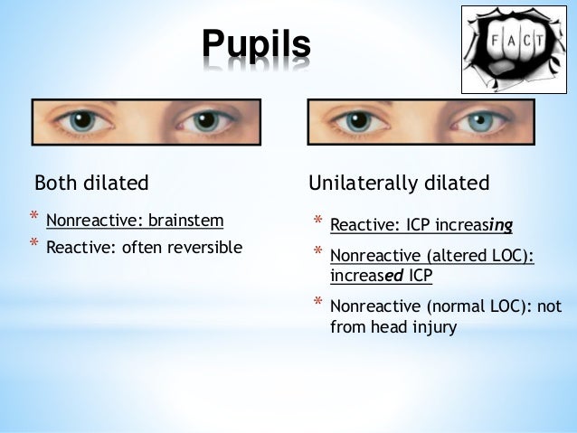 possible causes unequal pupil size