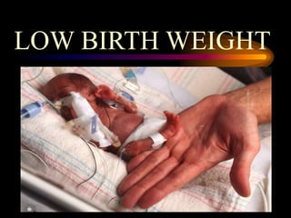 LOW BIRTH WEIGHT
 
