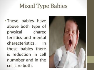 Low Birth Weight LBW - Presented By Mohammed Haroon Rashid | PPTX