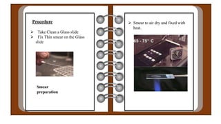 Procedure
 Take Clean a Glass slide
 Fix Thin smear on the Glass
slide
Smear
preparation
 Smear to air dry and fixed with
heat.
 