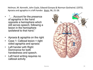 Apraxia 30
Heilman, M. Kenneth, John Coyle, Edward Gonyea & Norman Geshwind. (1973).
Apraxia and agraphia in a left hander. Brain, 96, 21-28.
• “. . .Account for the presence
of agraphia in the hand
opposite a hemisphere which
still serves speech, following a
lesion in the hemisphere
ipsilateral to that hand.”
• Apraxia & agraphia on the right
• Case 1: Callosal lesion = right
sided agraphia and apraxia
• Left hander with Right
Dominance for both
handedness and speech.
• Left hand writing requires no
callosal activity
SPEECH
Skilled
Engrams
Motor
Control
Motor
Control
 