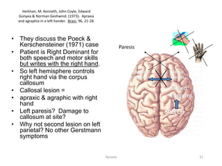 Apraxia 31
Heilman, M. Kenneth, John Coyle, Edward
Gonyea & Norman Geshwind. (1973). Apraxia
and agraphia in a left hander. Brain, 96, 21-28.
• They discuss the Poeck &
Kerschensteiner (1971) case
• Patient is Right Dominant for
both speech and motor skills
but writes with the right hand.
• So left hemisphere controls
right hand via the corpus
callosum
• Callosal lesion =
• apraxic & agraphic with right
hand
• Left paresis? Damage to
callosum at site?
• Why not second lesion on left
parietal? No other Gerstmann
symptoms
SPEECH
Skilled
Engrams
Motor
Control
Motor
Control
Paresis
 