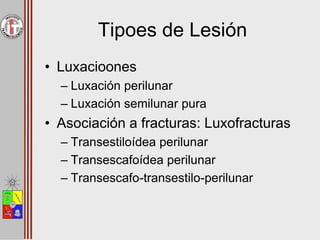 Tipoes de Lesión
• Luxacioones
– Luxación perilunar
– Luxación semilunar pura
• Asociación a fracturas: Luxofracturas
– Transestiloídea perilunar
– Transescafoídea perilunar
– Transescafo-transestilo-perilunar
 