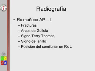 Radiografía
• Rx muñeca AP – L
– Fracturas
– Arcos de Guilula
– Signo Terry Thomas
– Signo del anillo
– Posición del semilunar en Rx L
 