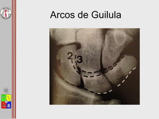Arcos de Guilula
 