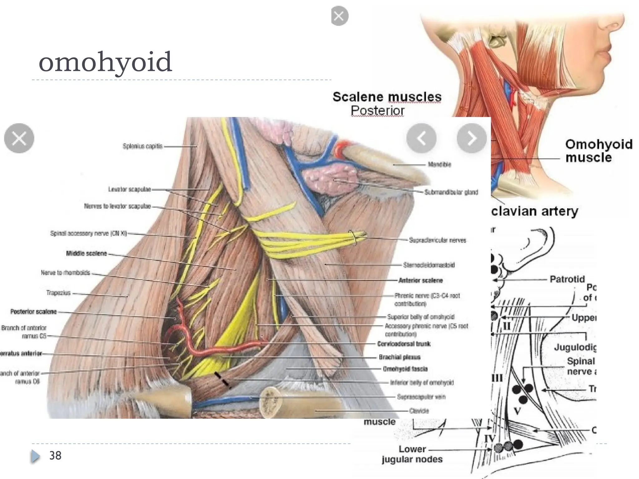 Dissected Neck Neck dissection part 1 head and neck scca | PPT