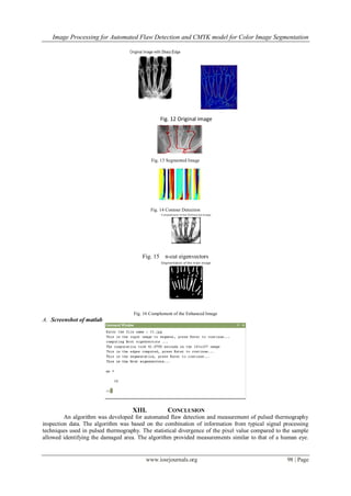 Image Processing for Automated Flaw Detection and CMYK model for Color Image Segmentation
www.iosrjournals.org 98 | Page
Fig. 12 Original image
Fig. 13 Segmented Image
Fig. 14 Contour Detection
Fig. 15 n-cut eigenvectors
Fig. 16 Complement of the Enhanced Image
A. Screenshot of matlab
XIII. CONCLUSION
An algorithm was developed for automated flaw detection and measurement of pulsed thermography
inspection data. The algorithm was based on the combination of information from typical signal processing
techniques used in pulsed thermography. The statistical divergence of the pixel value compared to the sample
allowed identifying the damaged area. The algorithm provided measurements similar to that of a human eye.
 