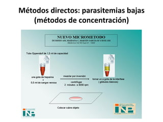 Métodos directos: parasitemias bajas
(métodos de concentración)
 