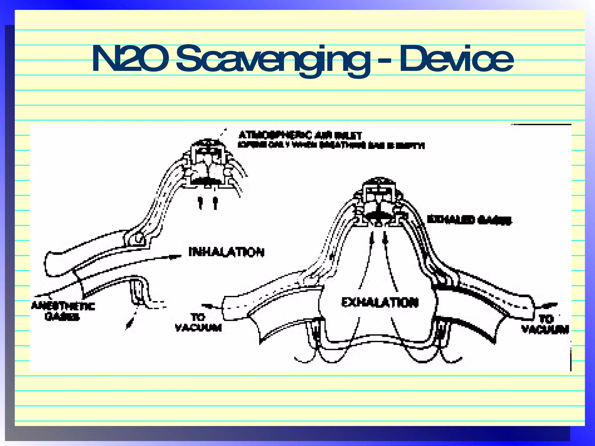 Nitrous Oxide Sedation in Pediatric Dentistry | PPT