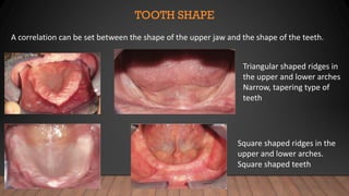 Comprehensive Guide to Anterior Tooth Selection and Arrangement in ...