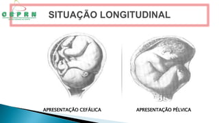 APRESENTAÇÃO CEFÁLICA APRESENTAÇÃO PÉLVICA
 
