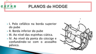  I. Polo cefálico na borda superior
do pube
 II. Borda inferior do pube
 III. Ao nível das espinhas ciática.
 IV. Ao nível da ponta do cóccige e
confundindo-se com o assoalho
pélvico.
 