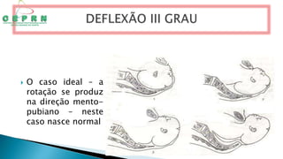  O caso ideal – a
rotação se produz
na direção mento-
pubiano – neste
caso nasce normal
 