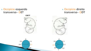  Occipício direito
transverso- ODT
 Occipício esquerdo
transverso- OET
P
S
EA
EP
DA
DP
P
S
EA
EP
DA
DP
ET
DT
DT ET
 