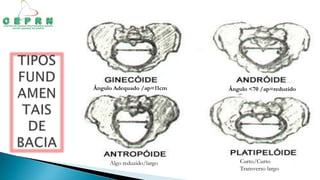 Ângulo Adequado /ap=11cm Ângulo <70 /ap=reduzido
Algo reduzido/largo Curto/Curto
Transverso largo
 