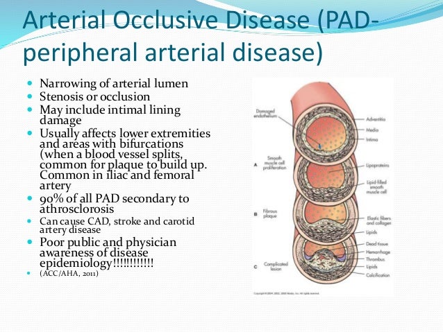 N325 Peripheral Vascular Student Version