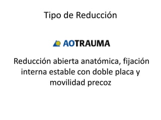 Tipo de Reducción
Reducción abierta anatómica, fijación
interna estable con doble placa y
movilidad precoz
 