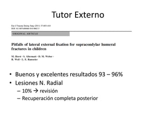 Tutor Externo
• Buenos y excelentes resultados 93 – 96%
• Lesiones N. Radial
– 10%  revisión
– Recuperación completa posterior
 
