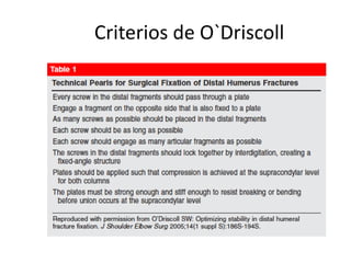 Criterios de O`Driscoll
 