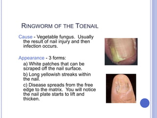 RINGWORM OF THE TOENAIL
Cause - Vegetable fungus. Usually
the result of nail injury and then
infection occurs.
Appearance - 3 forms:
a) White patches that can be
scraped off the nail surface.
b) Long yellowish streaks within
the nail.
c) Disease spreads from the free
edge to the matrix. You will notice
the nail plate starts to lift and
thicken.
 