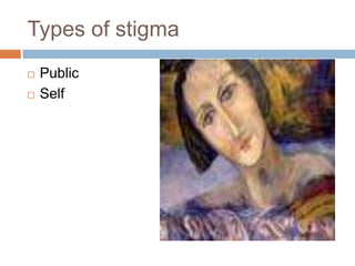 Types of stigma
   Public
   Self
 